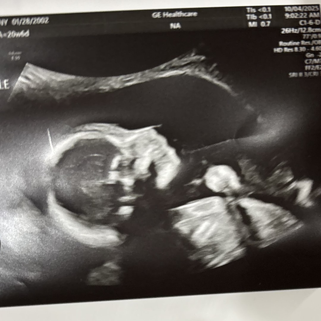 Photo shared by Destiny for their Babylist baby registry.