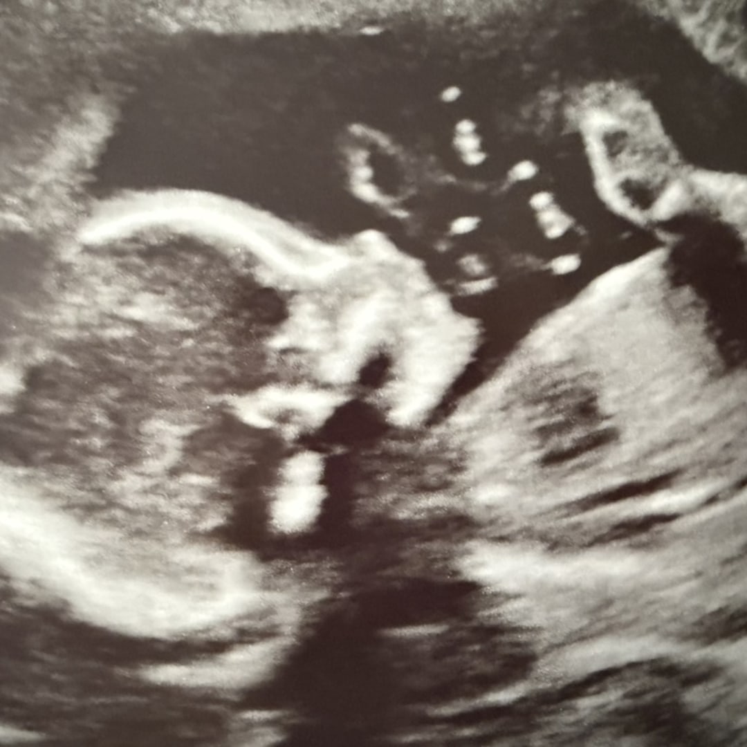 Photo shared by Erica for their Babylist baby registry.