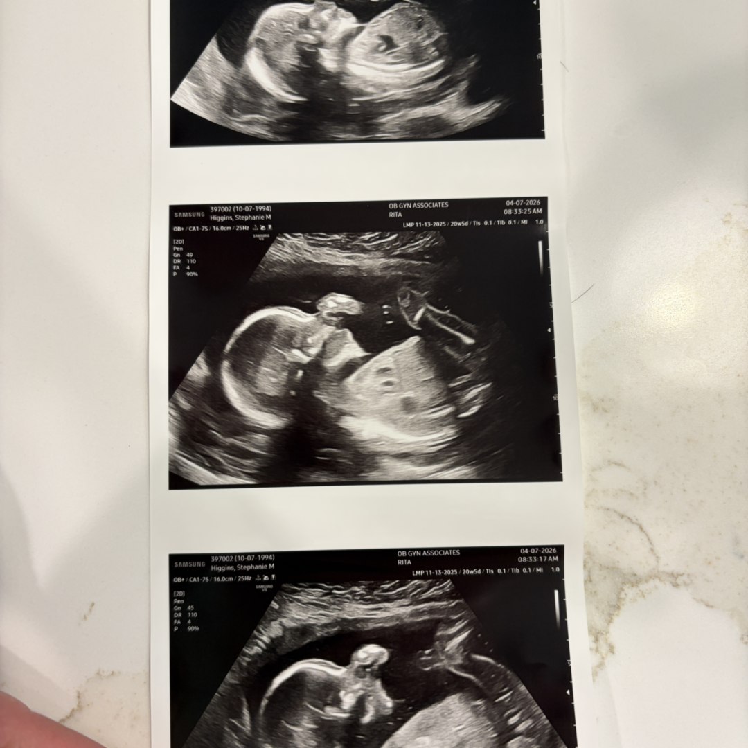 Photo shared by Stephanie for their Babylist baby registry.