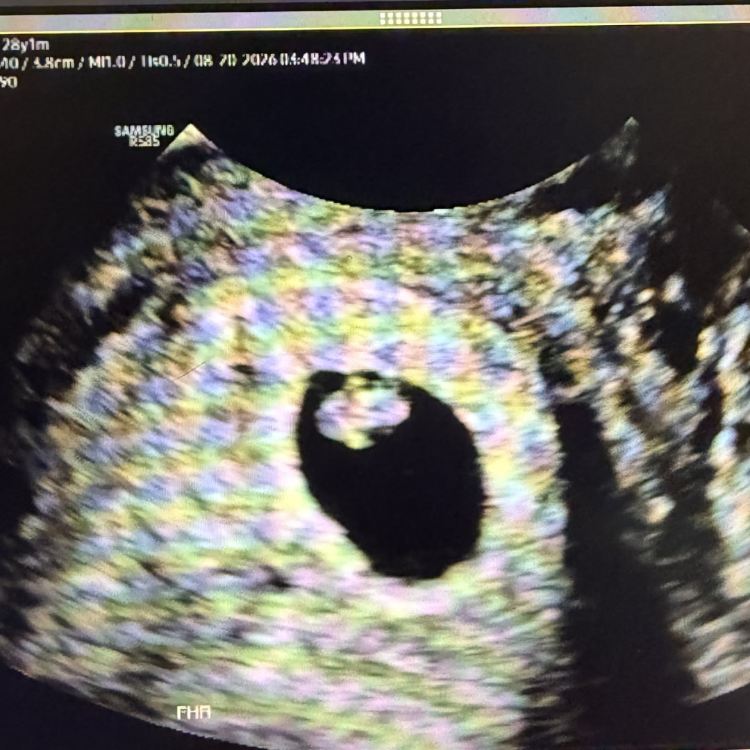 Photo shared by Madisyn for their Babylist baby registry.