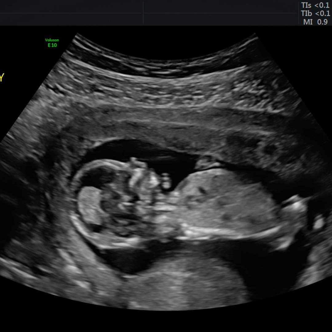 Photo shared by Julia for their Babylist baby registry.