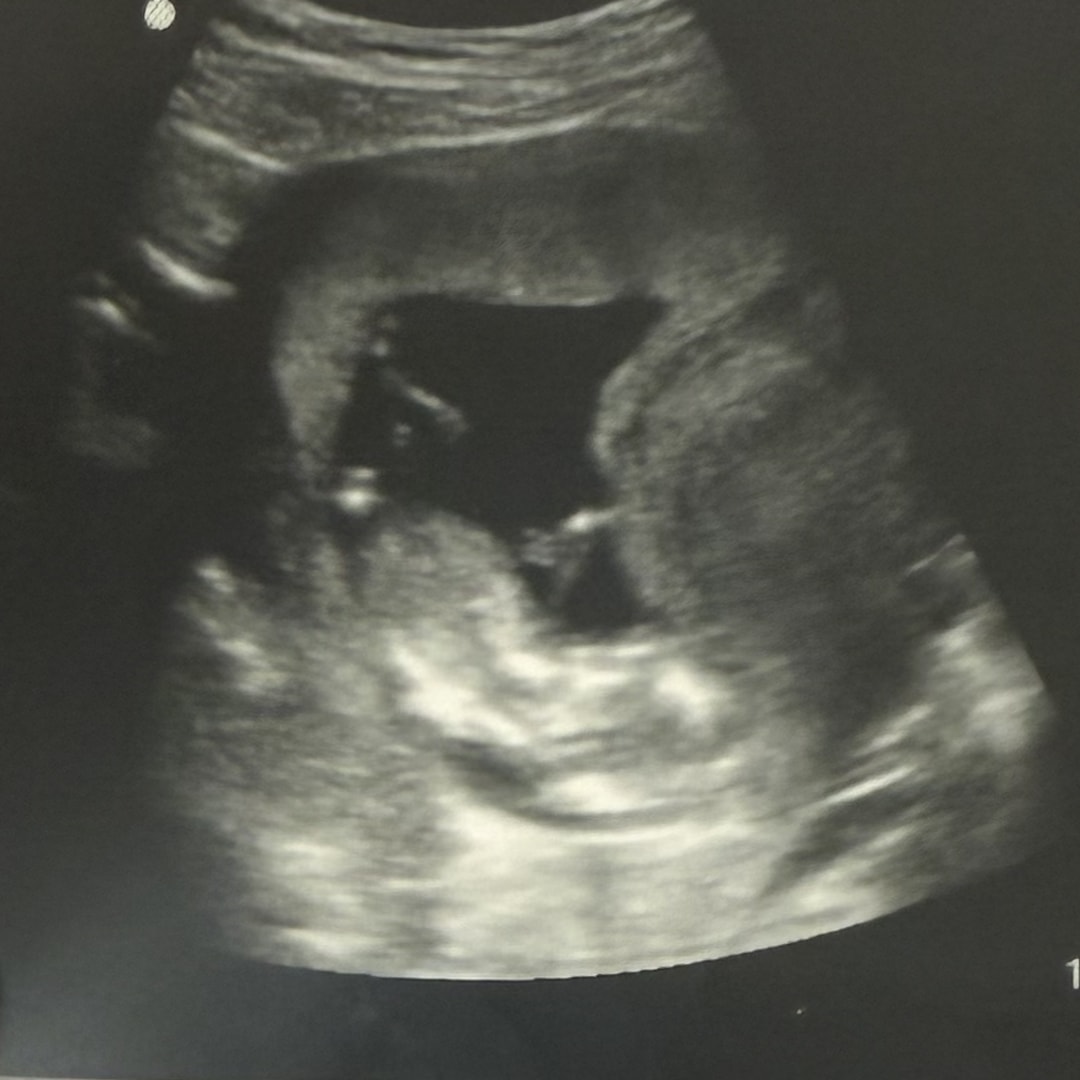 Photo shared by Ellie for their Babylist baby registry.