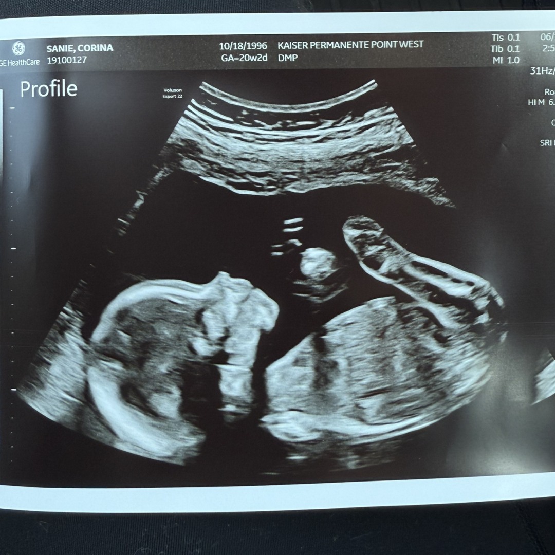 Photo shared by Corina for their Babylist baby registry.