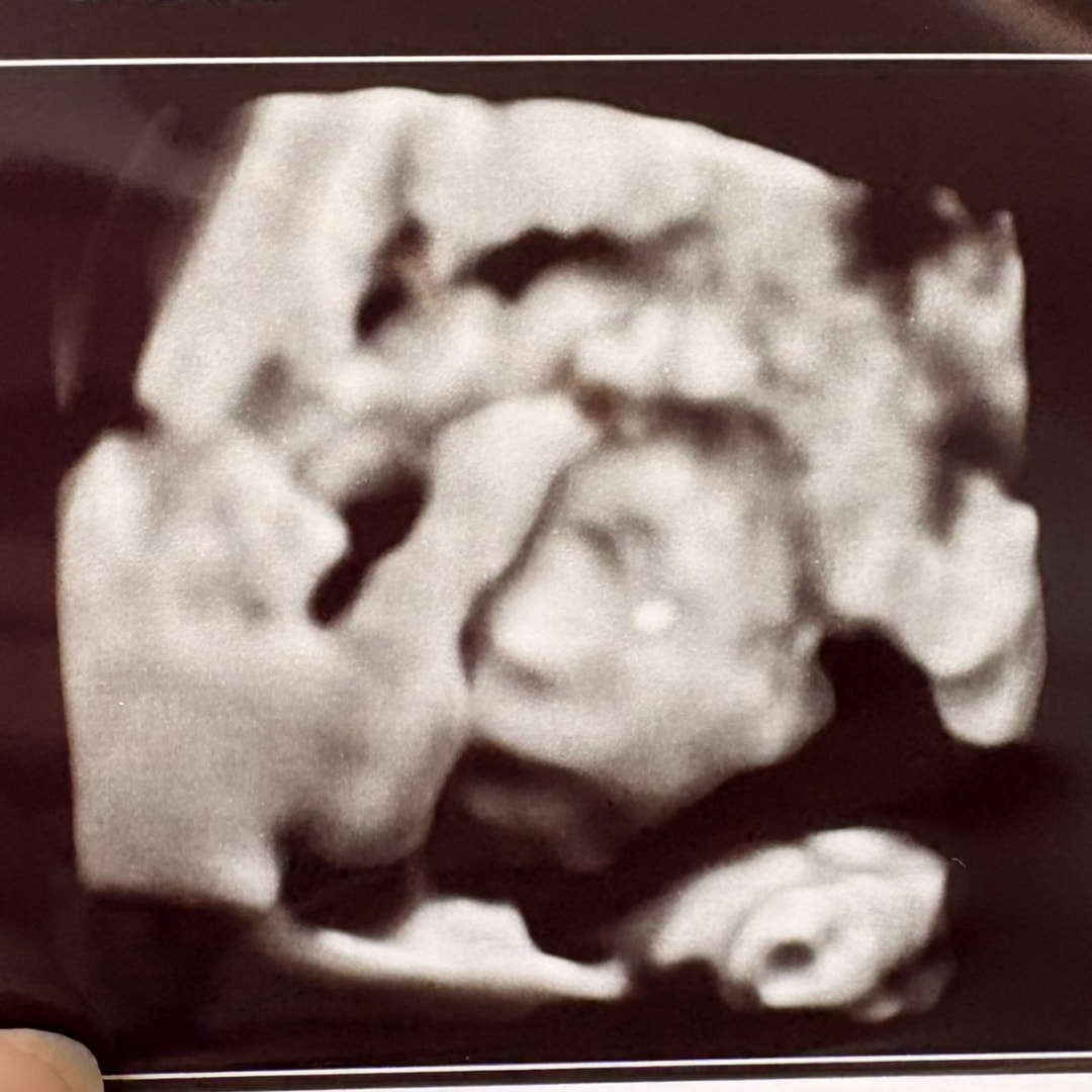 Photo shared by Remi for their Babylist baby registry.