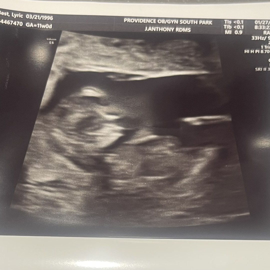 Photo shared by Lyric for their Babylist baby registry.