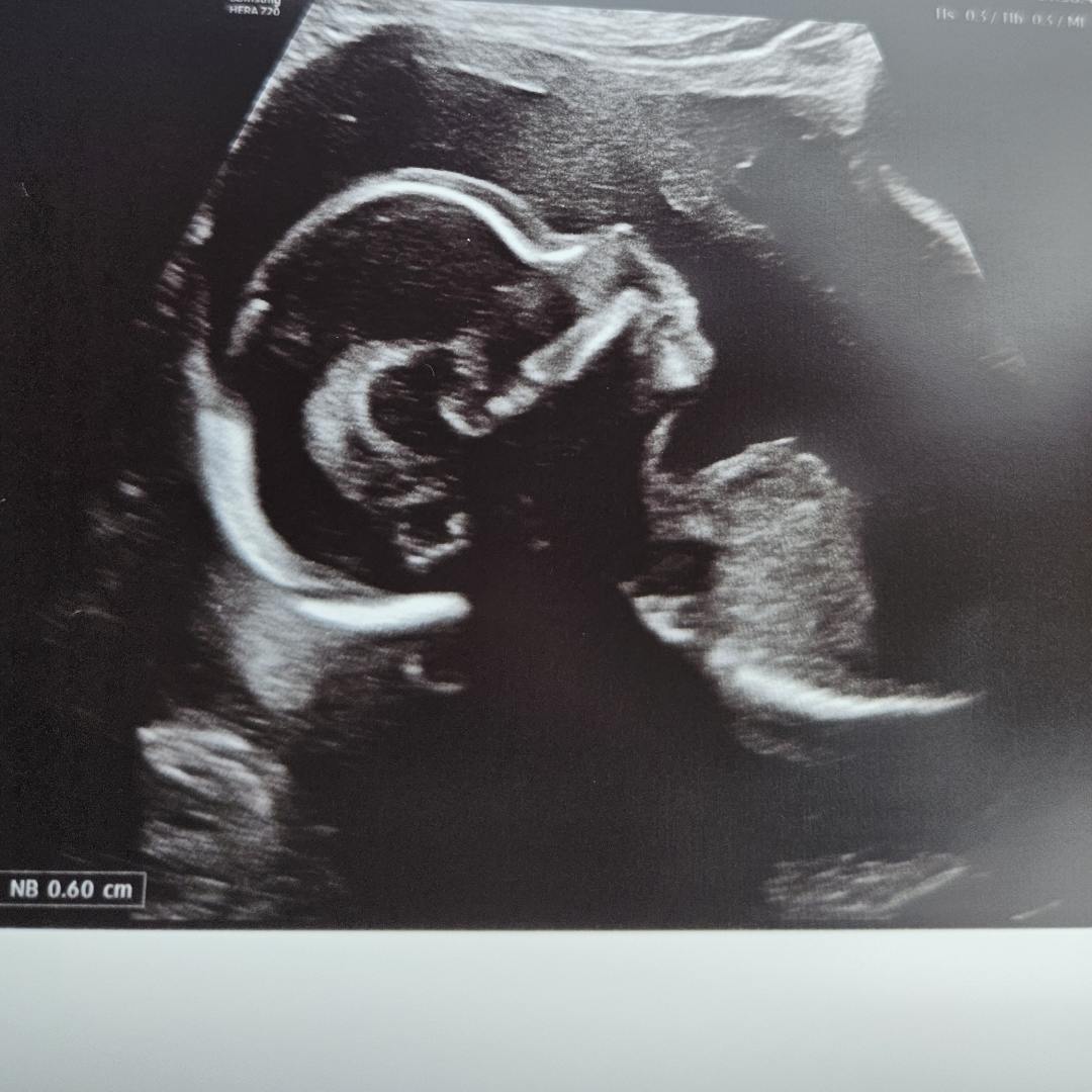 Photo shared by Amber for their Babylist baby registry.