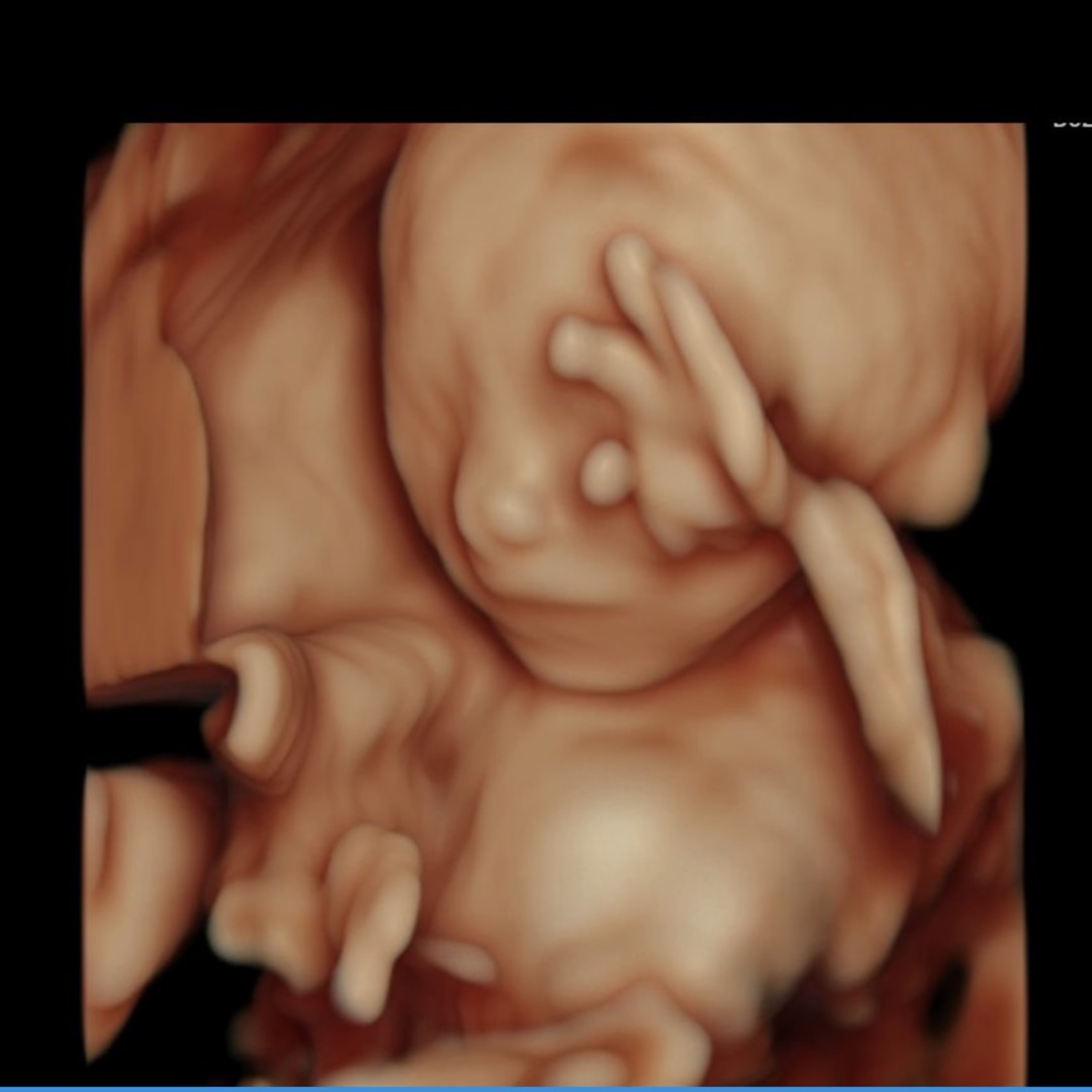 Photo shared by Kaci for their Babylist baby registry.