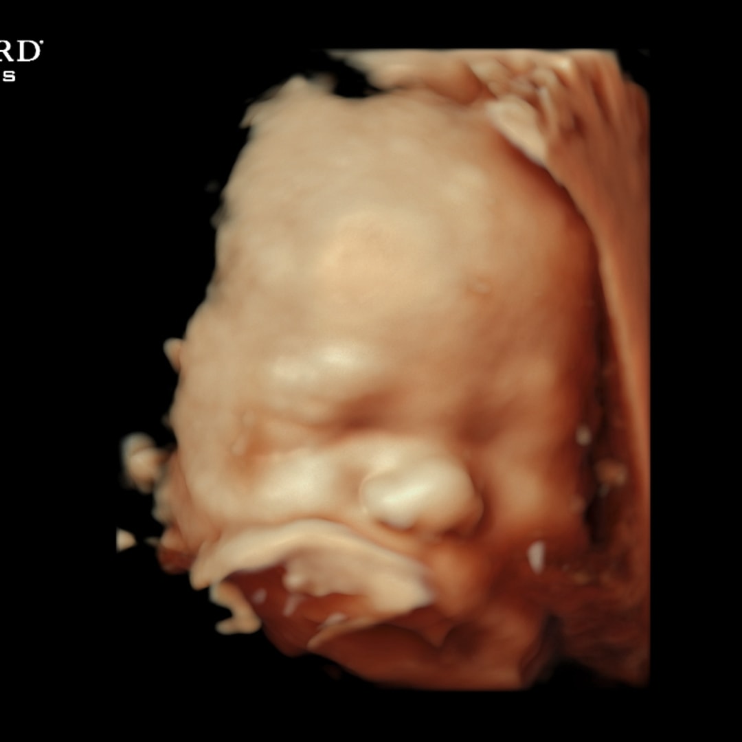 Photo shared by Shalyce for their Babylist baby registry.