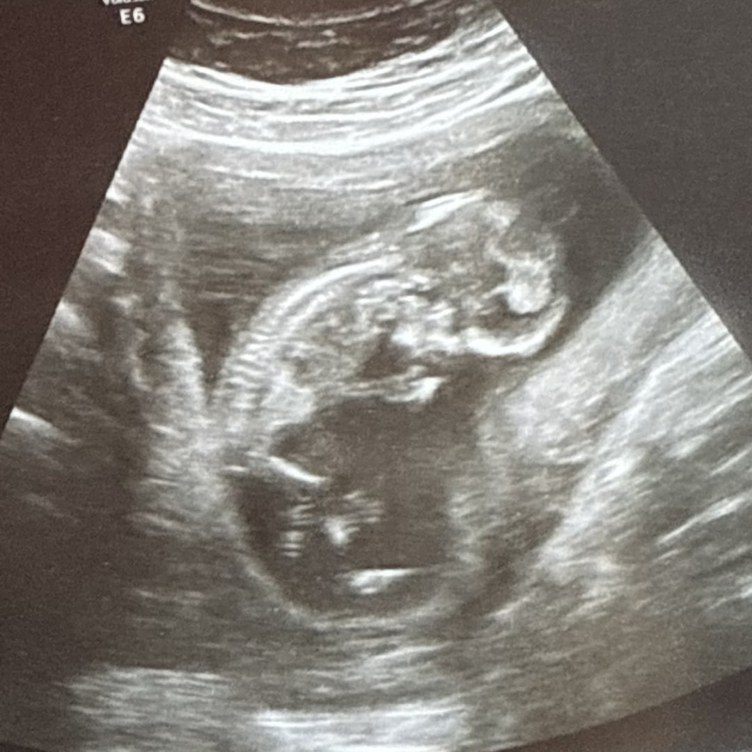 Photo shared by Jessica for their Babylist baby registry.