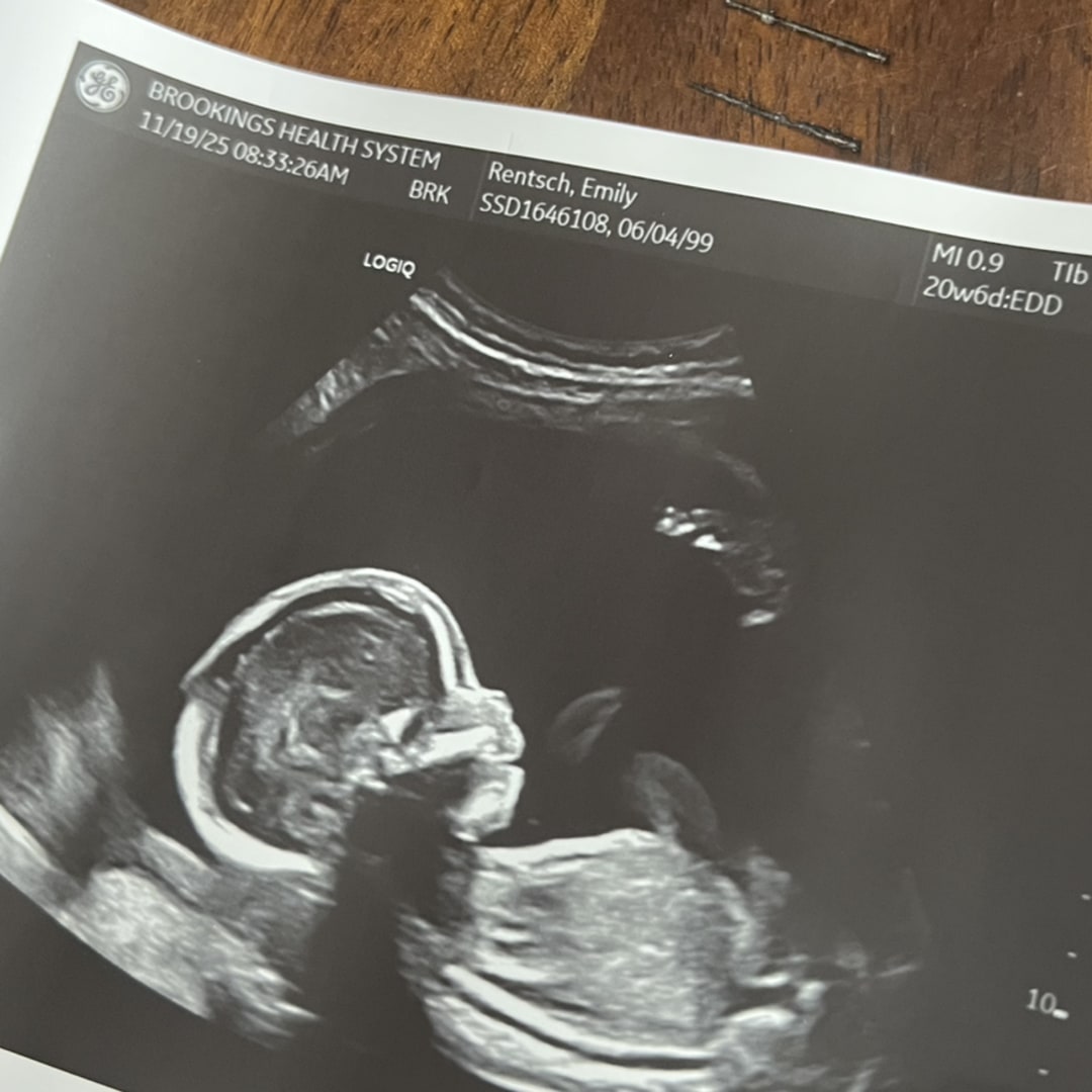 Photo shared by Emily for their Babylist baby registry.