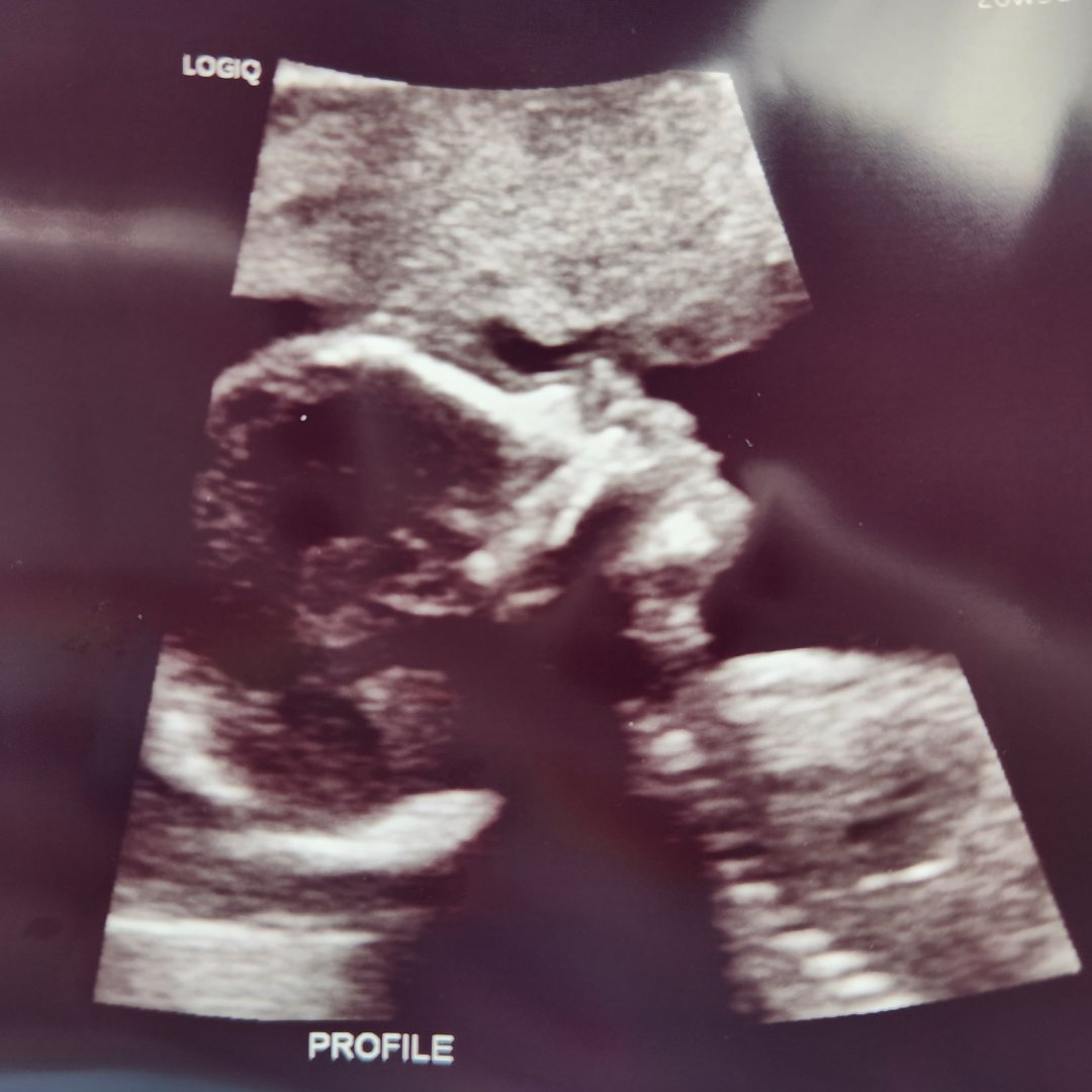 Photo shared by Melina for their Babylist baby registry.
