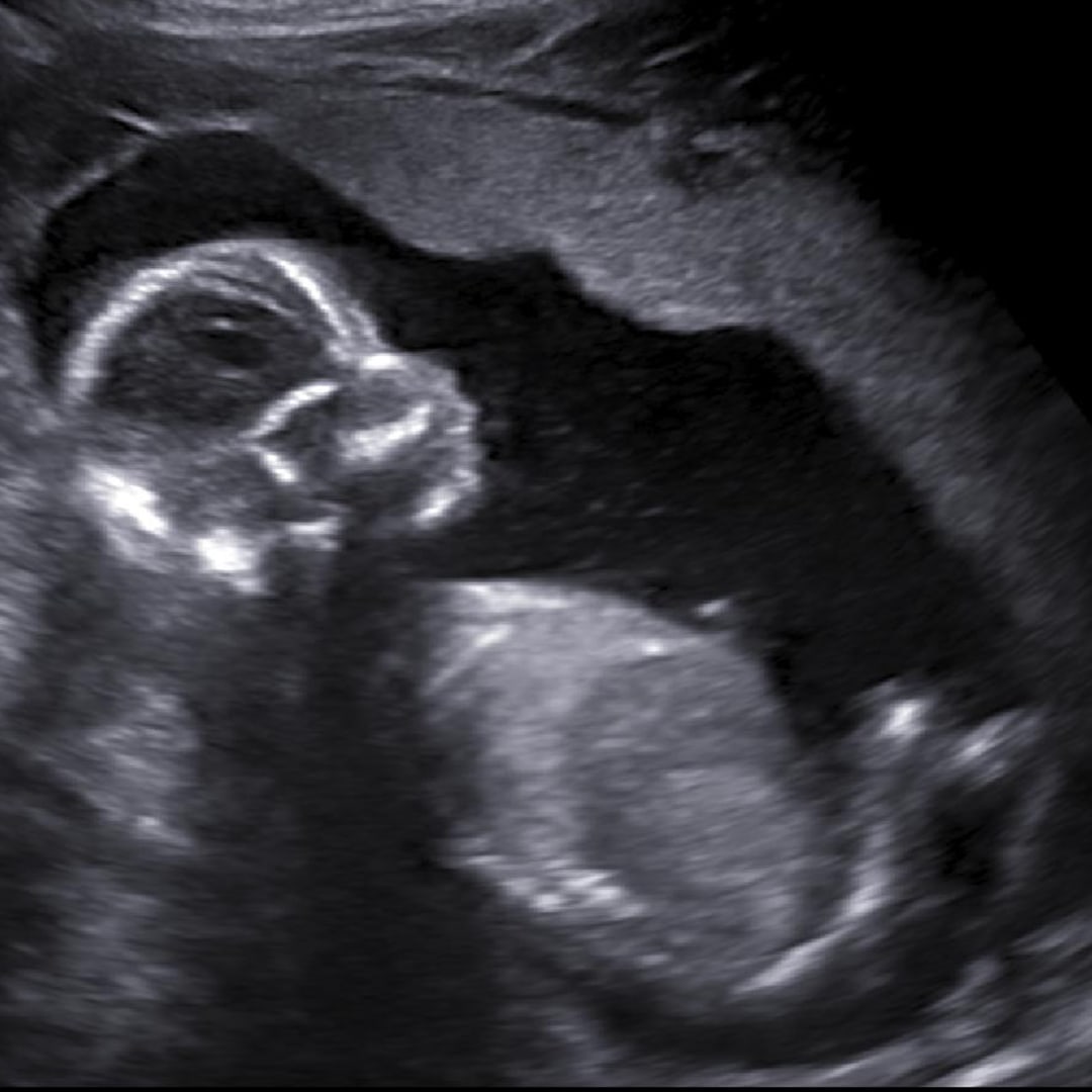 Photo shared by Amber for their Babylist baby registry.