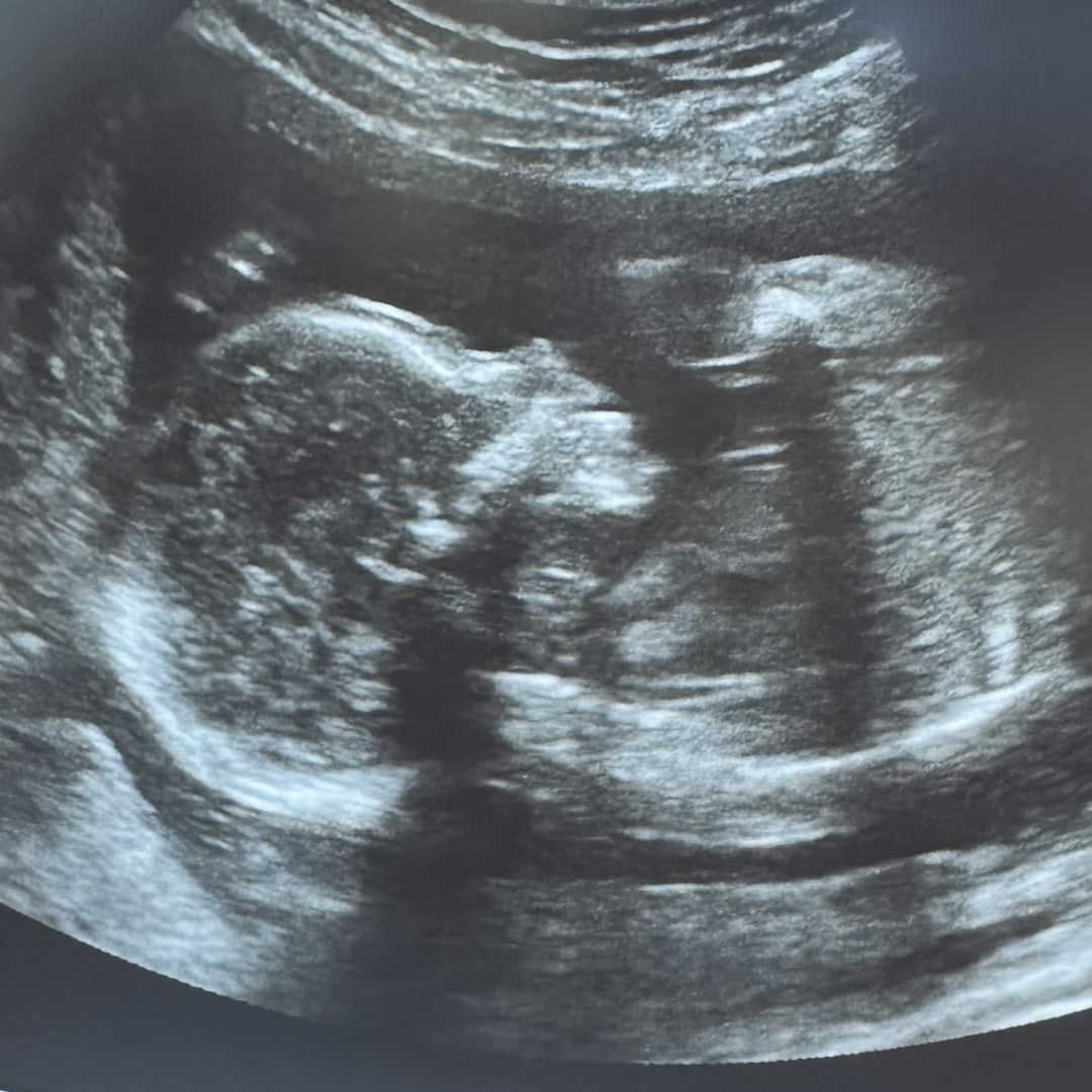 Photo shared by Ashley for their Babylist baby registry.