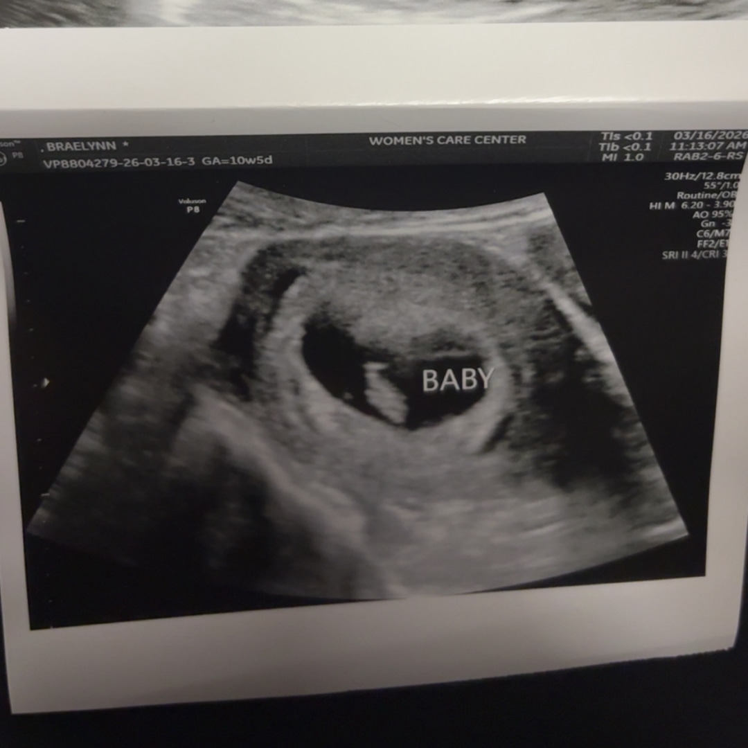 Photo shared by Braelynn for their Babylist baby registry.