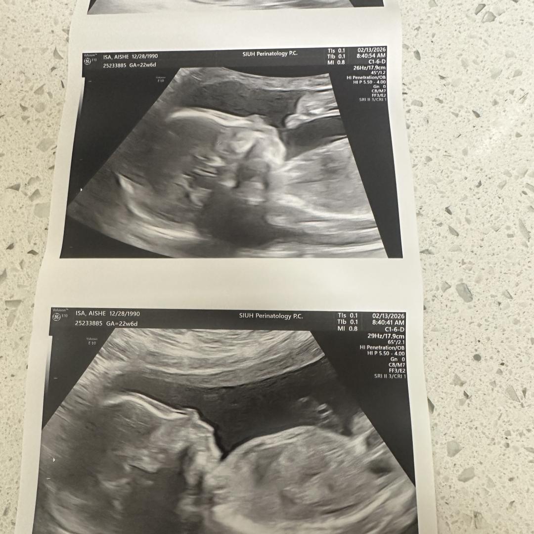 Photo shared by Aishe for their Babylist baby registry.