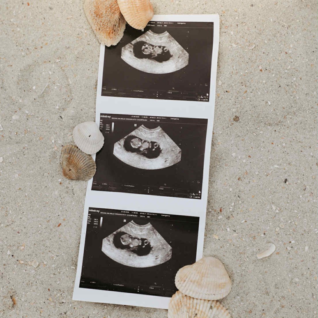 Photo shared by Michelle for their Babylist baby registry.