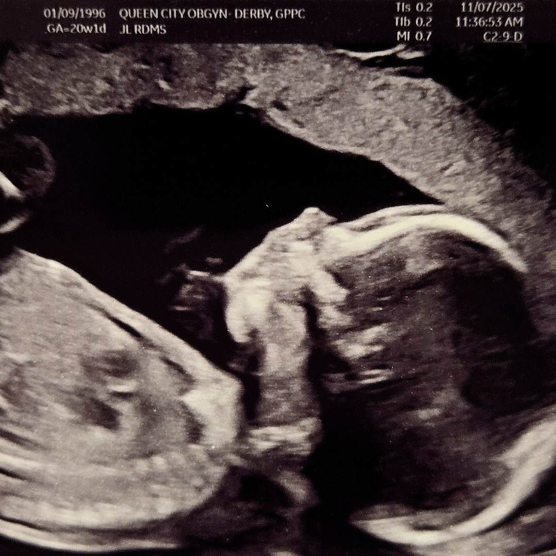 Photo shared by Kara for their Babylist baby registry.