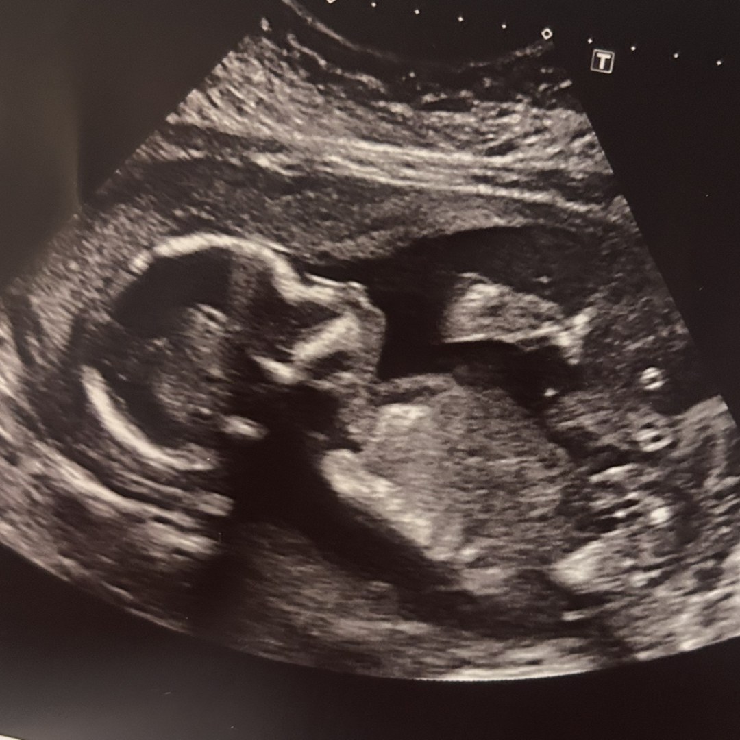 Photo shared by Kristal for their Babylist baby registry.