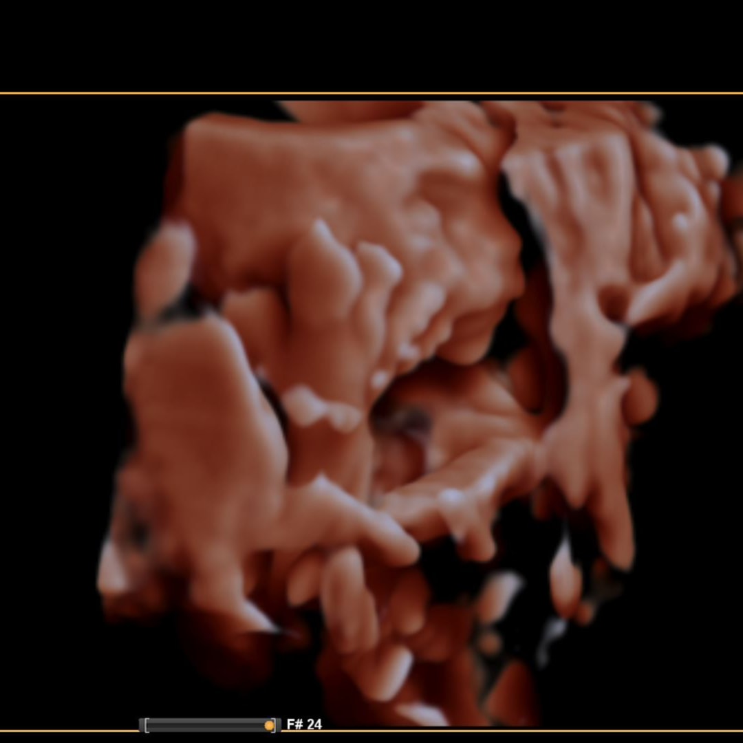 Photo shared by Rachelle for their Babylist baby registry.