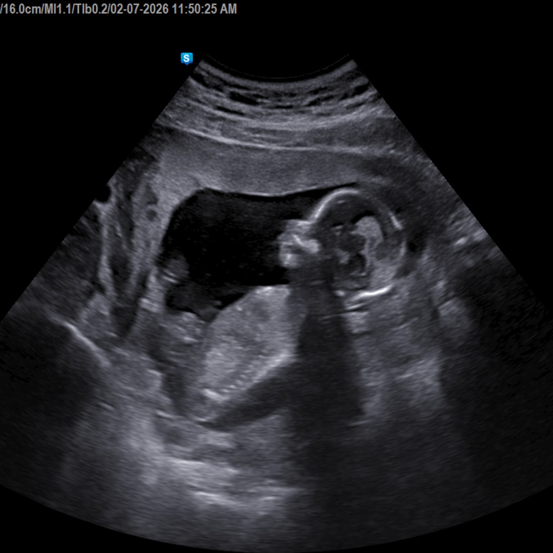 Photo shared by Mary-Harbin for their Babylist baby registry.