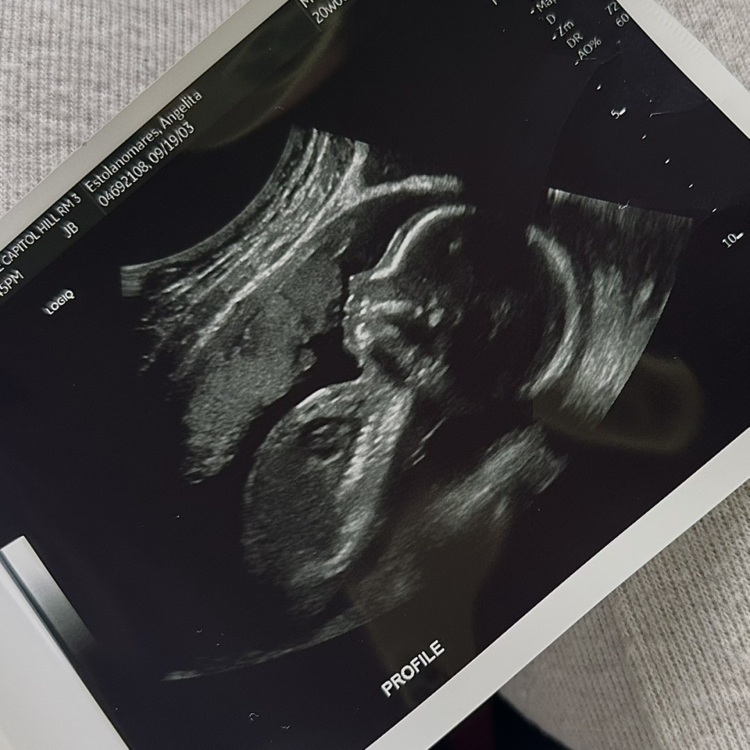 Photo shared by Angelita for their Babylist baby registry.