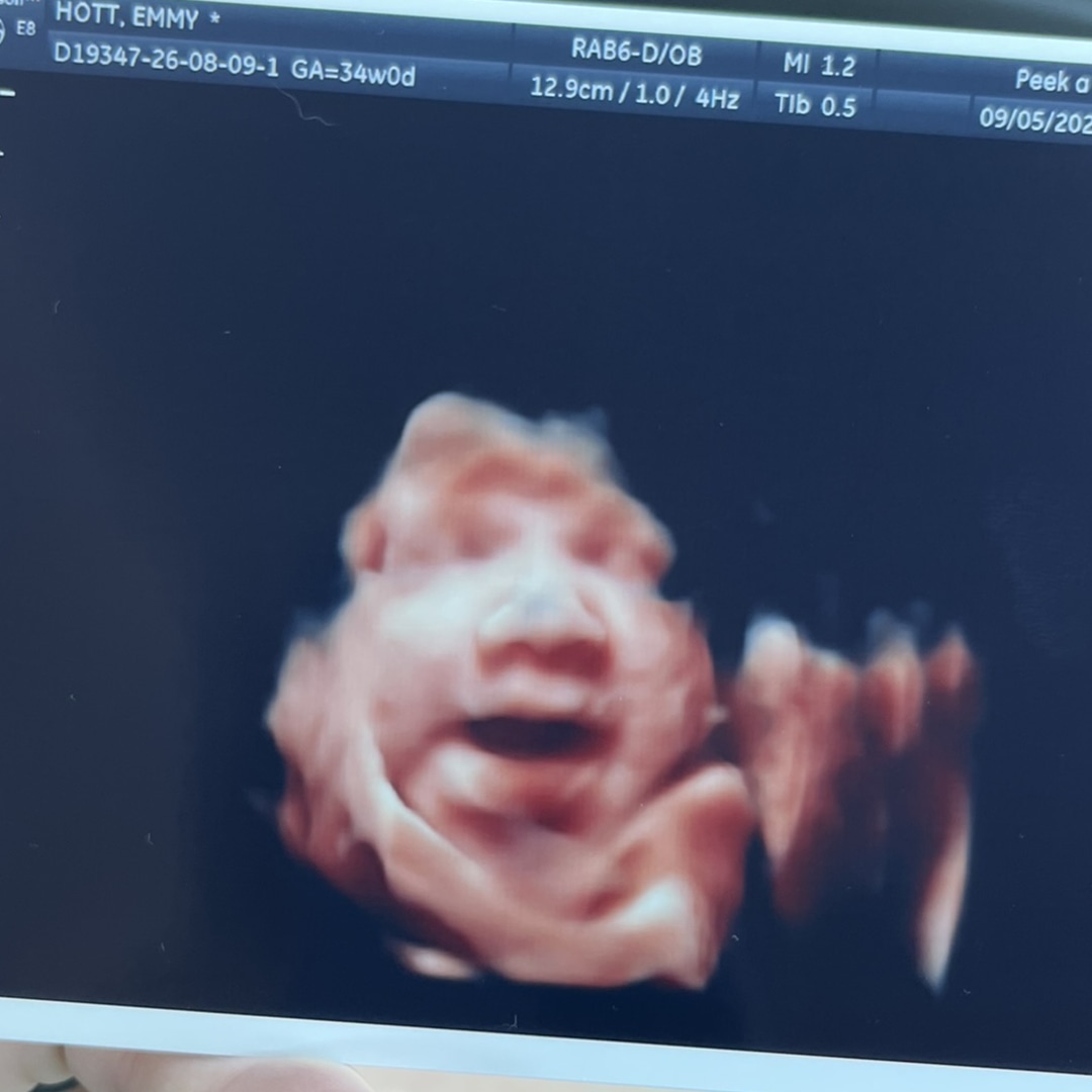 Photo shared by Emmy for their Babylist baby registry.