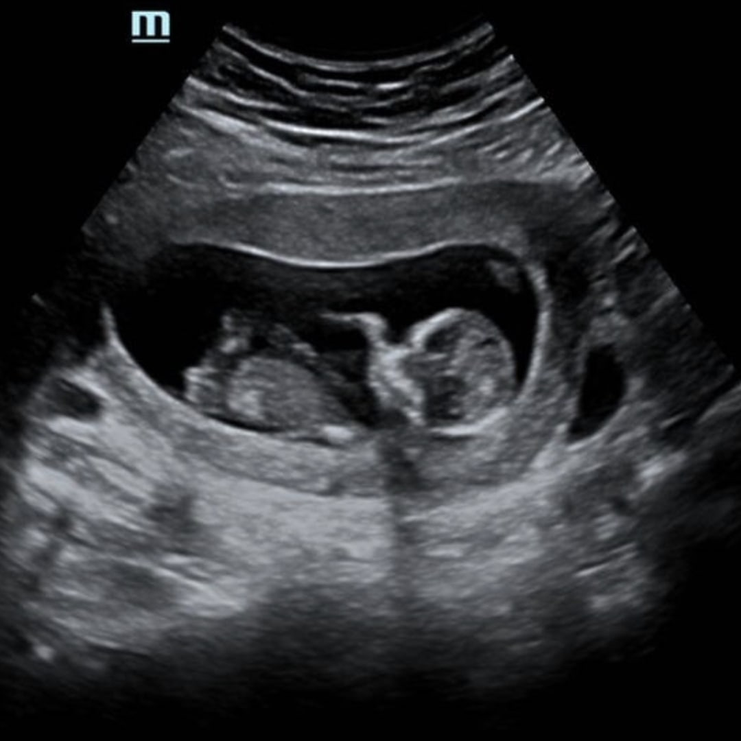 Photo shared by Rachel for their Babylist baby registry.