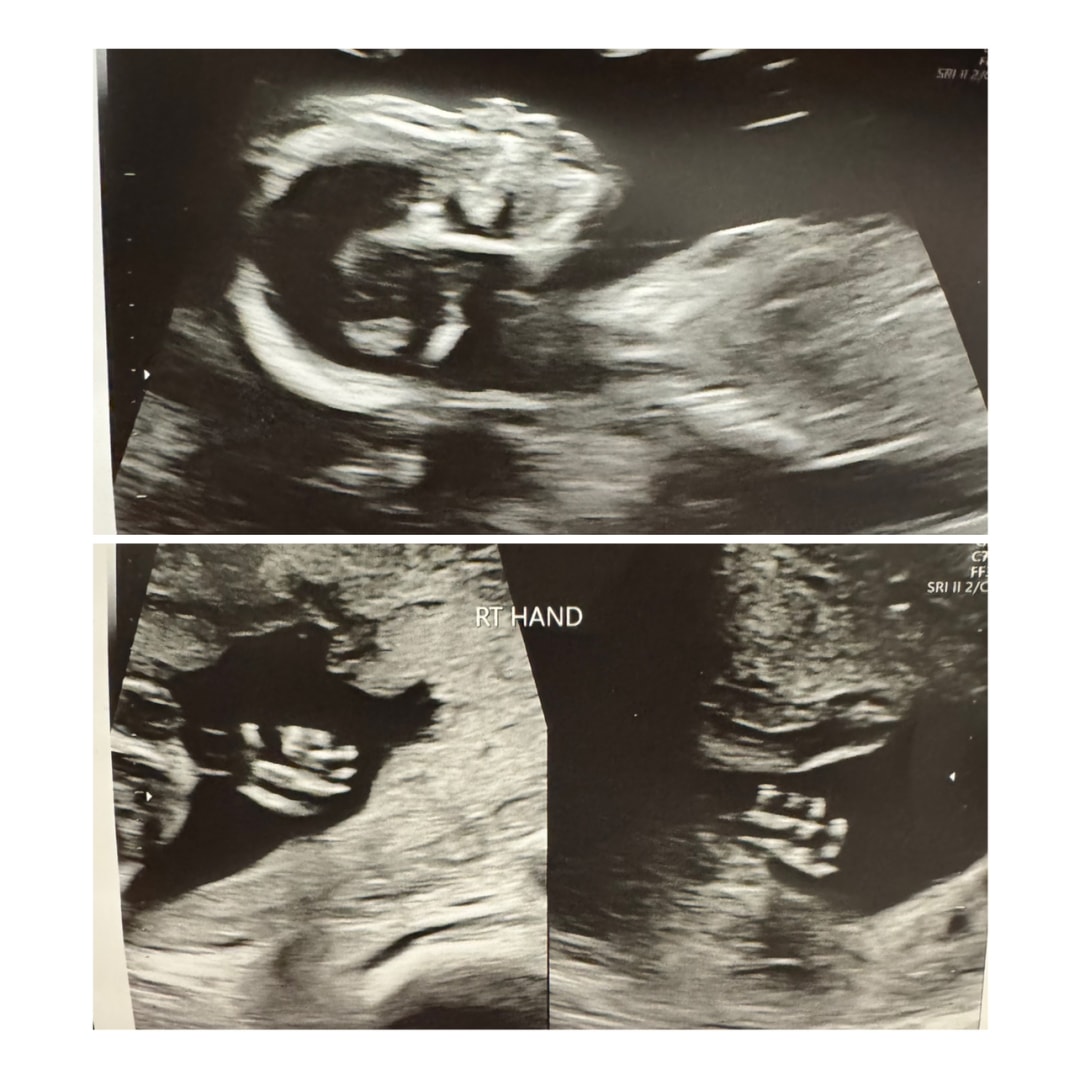Photo shared by Stephanie for their Babylist baby registry.