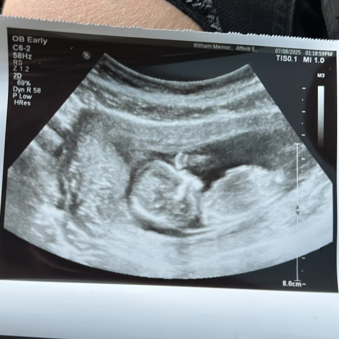 Photo shared by Allison for their Babylist baby registry.