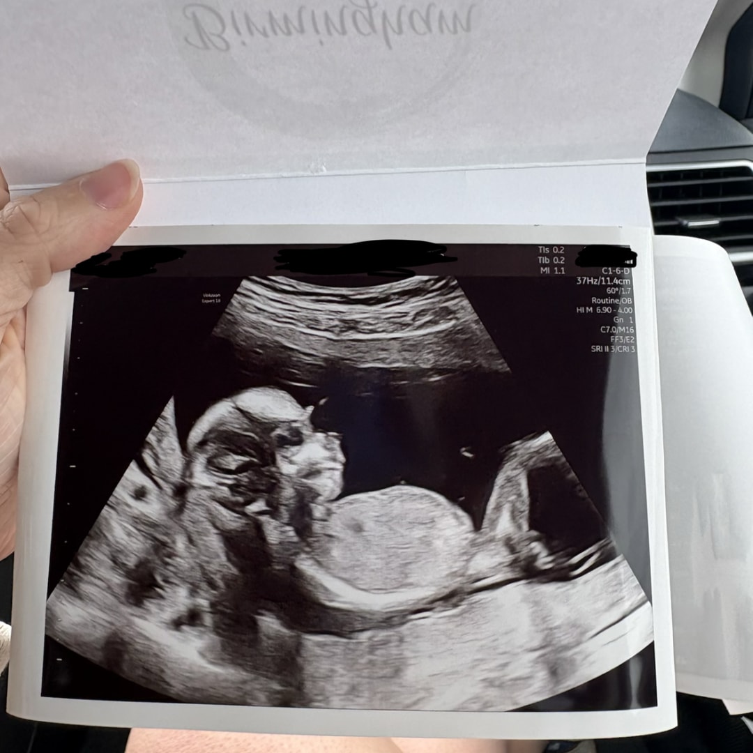 Photo shared by Caley for their Babylist baby registry.