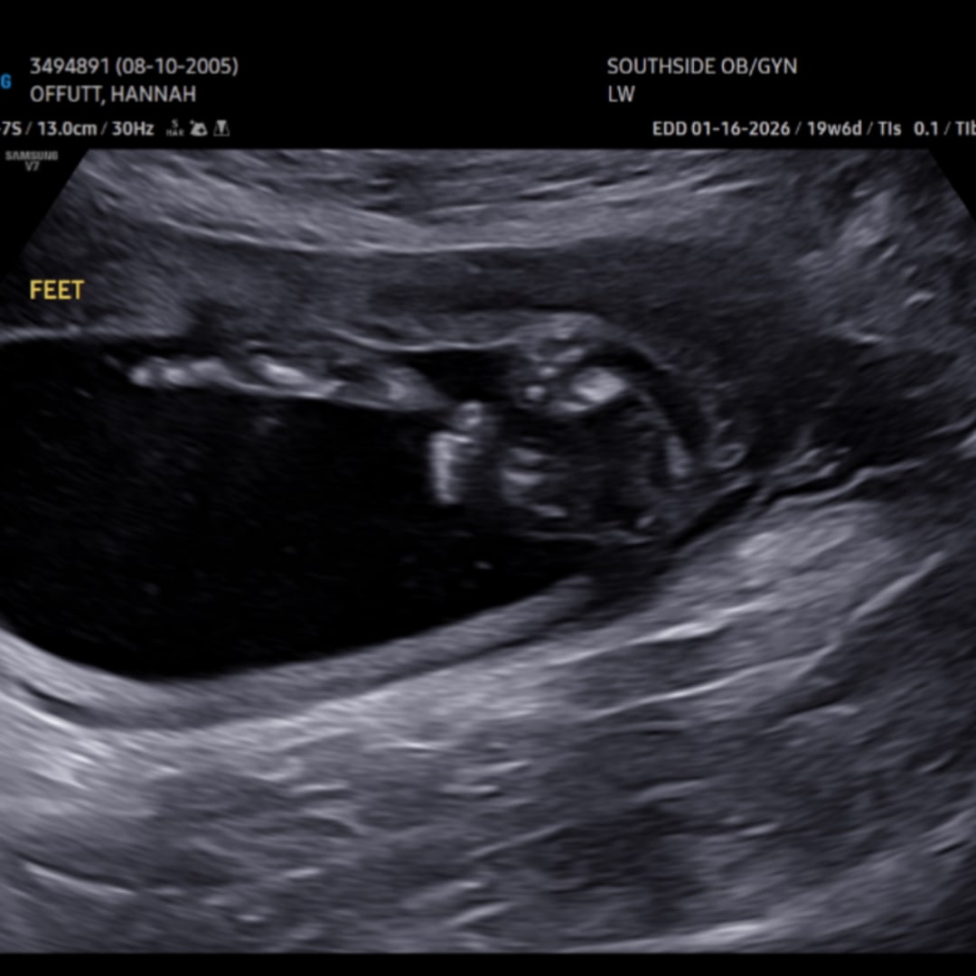 Photo shared by Hannah for their Babylist baby registry.