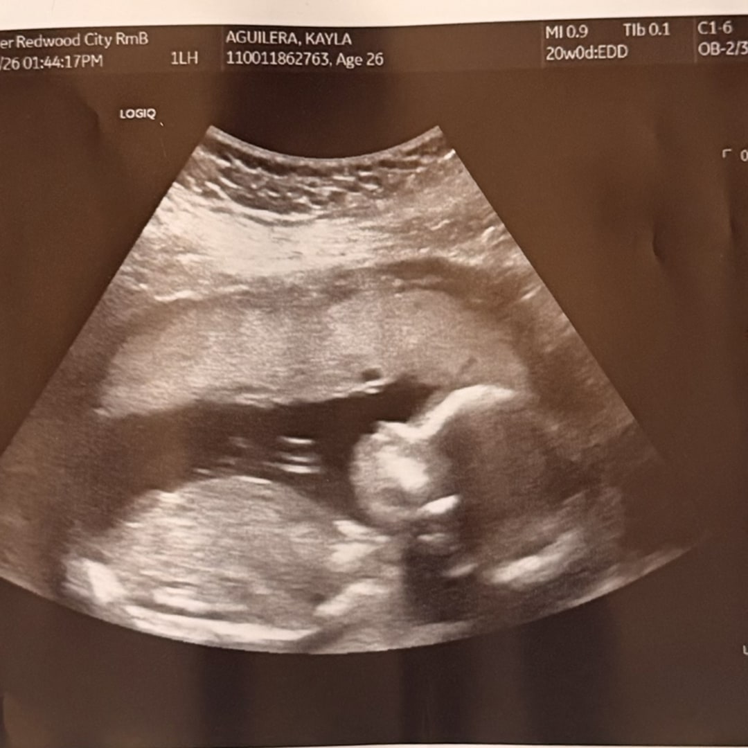 Photo shared by Kayla for their Babylist baby registry.