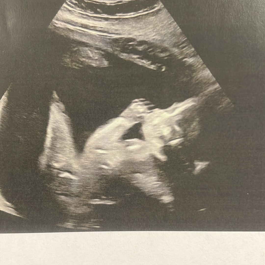 Photo shared by Melissa for their Babylist baby registry.