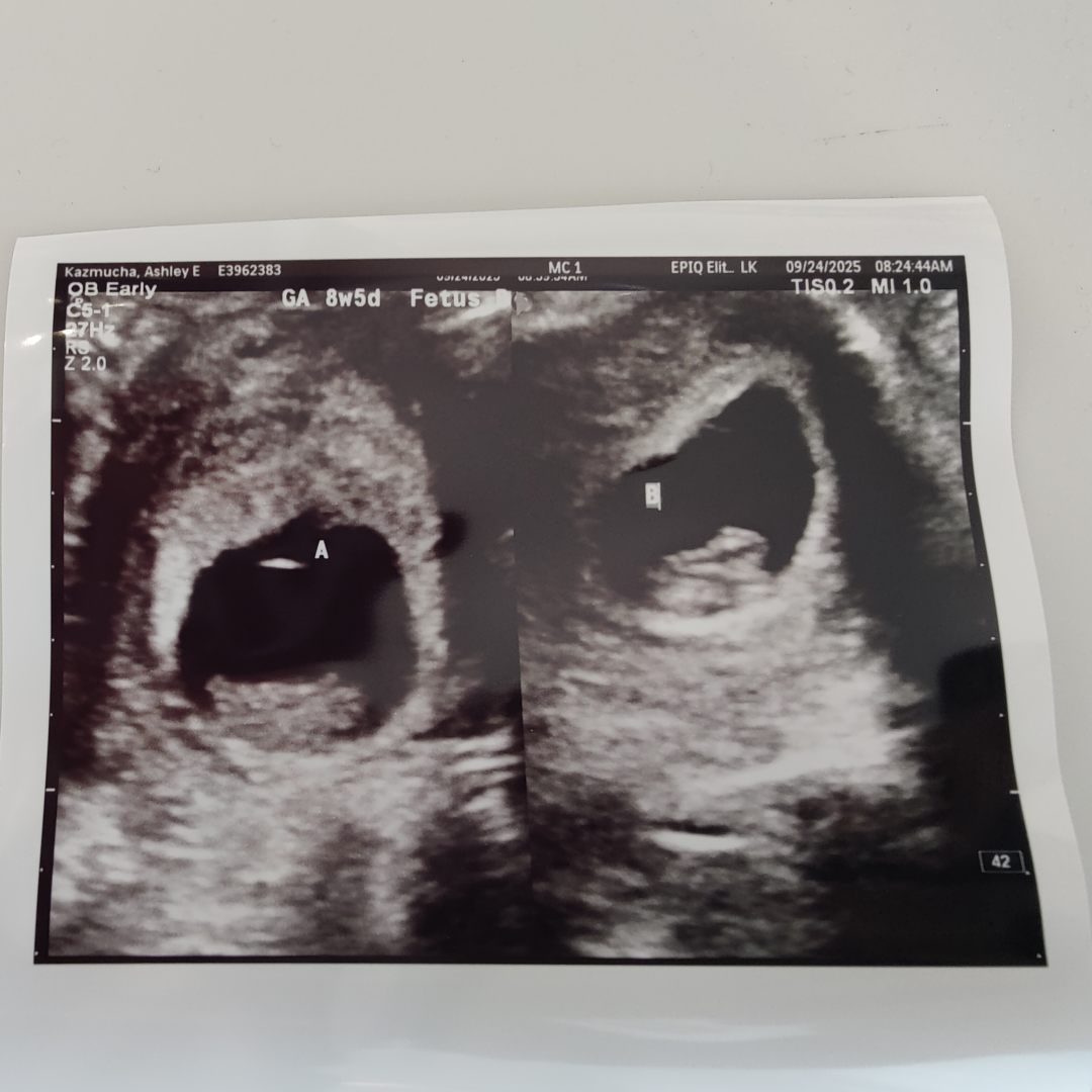 Photo shared by Ashley for their Babylist baby registry.