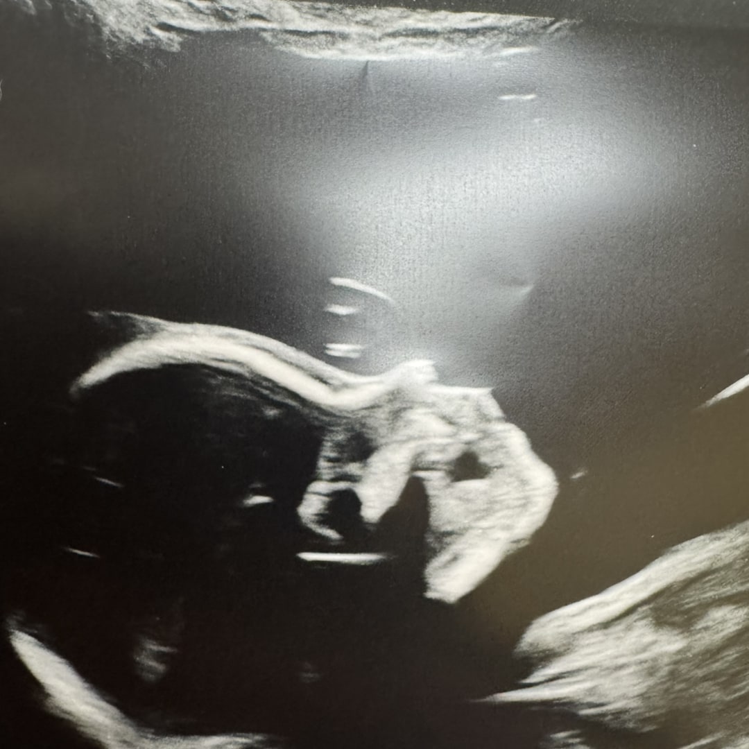 Photo shared by Amanda for their Babylist baby registry.