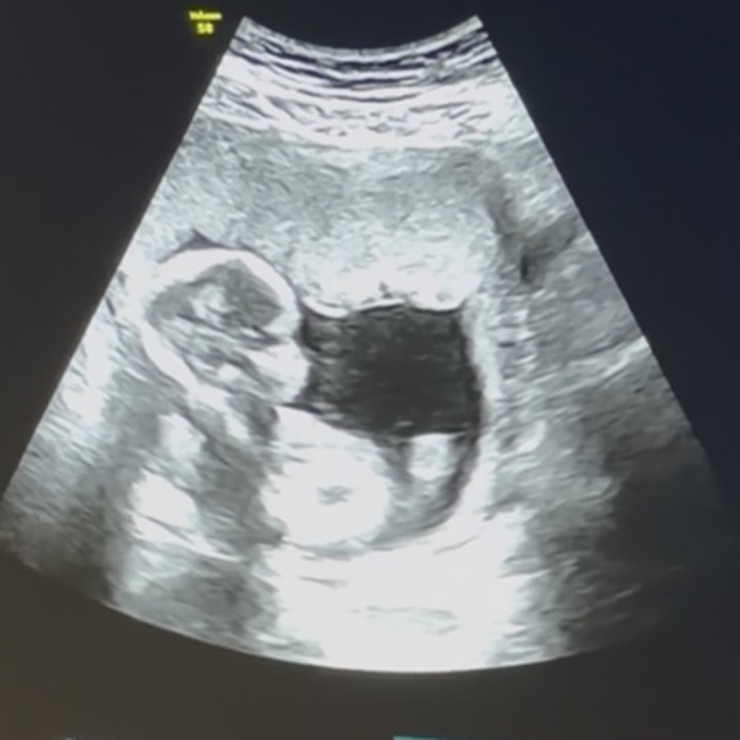 Photo shared by Michaela for their Babylist baby registry.