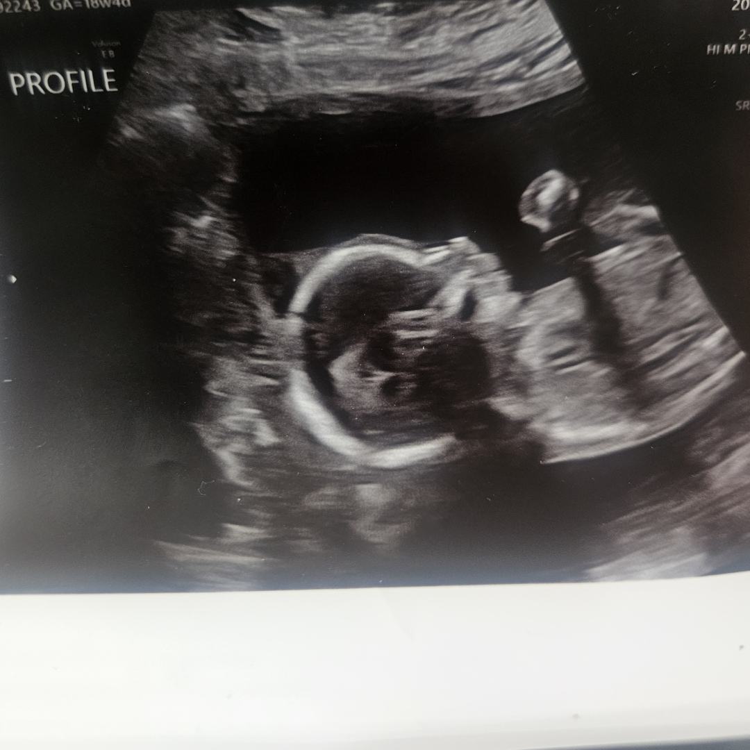 Photo shared by Kayla for their Babylist baby registry.
