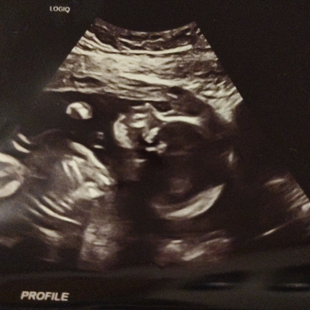 Photo shared by Ivey for their Babylist baby registry.
