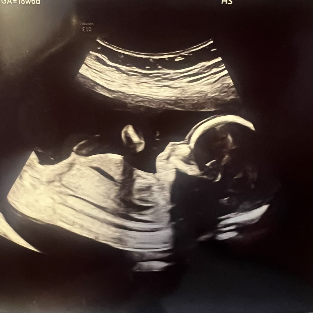 Photo shared by Julie for their Babylist baby registry.