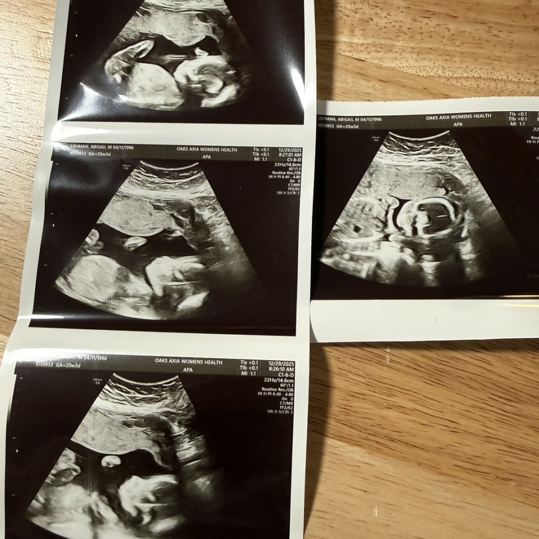 Photo shared by Abigail for their Babylist baby registry.