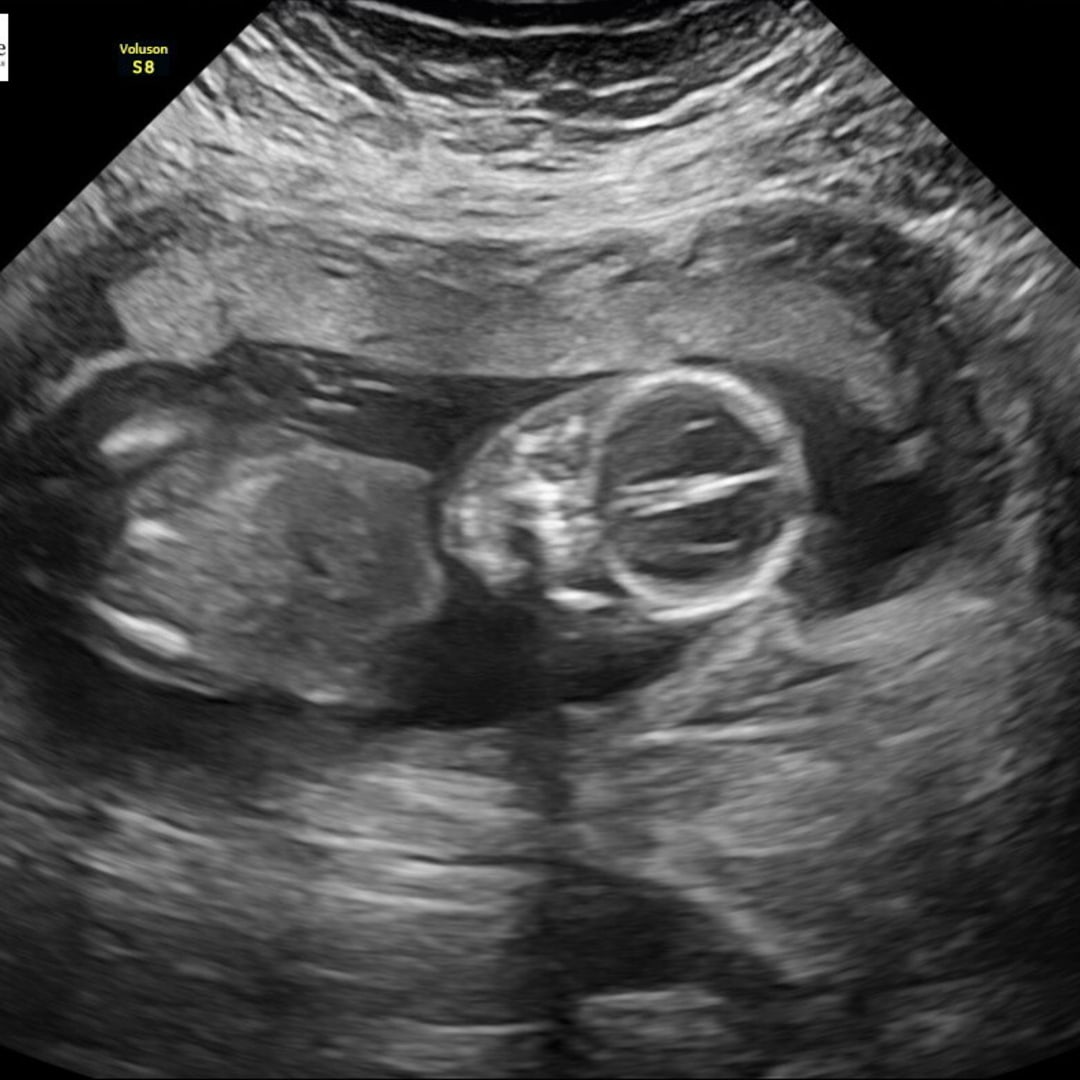 Photo shared by Brittany for their Babylist baby registry.