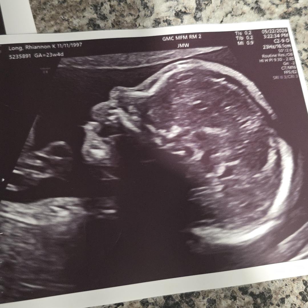 Photo shared by Rhiannon for their Babylist baby registry.
