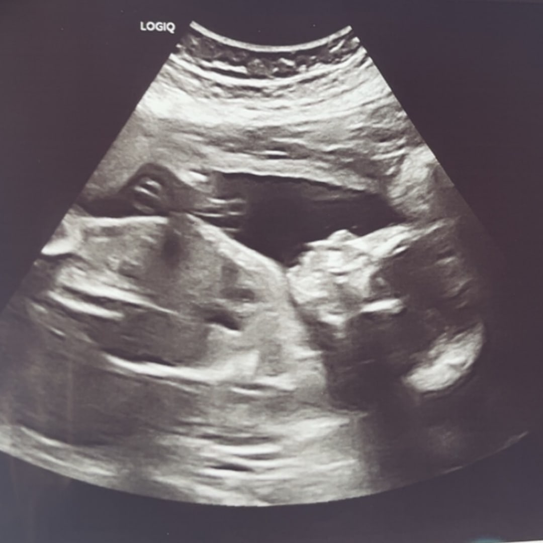 Photo shared by Madilyn for their Babylist baby registry.