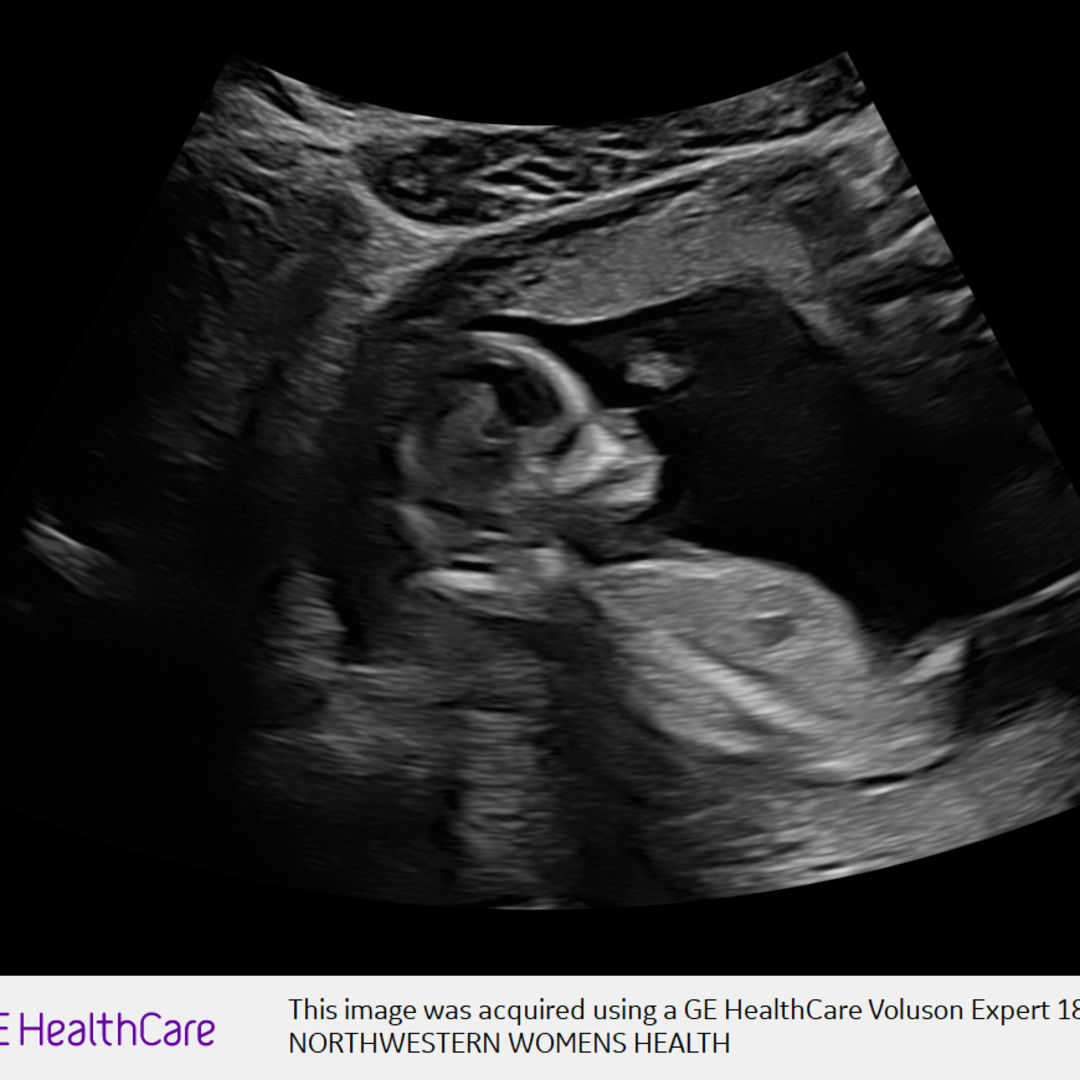 Photo shared by Christian for their Babylist baby registry.