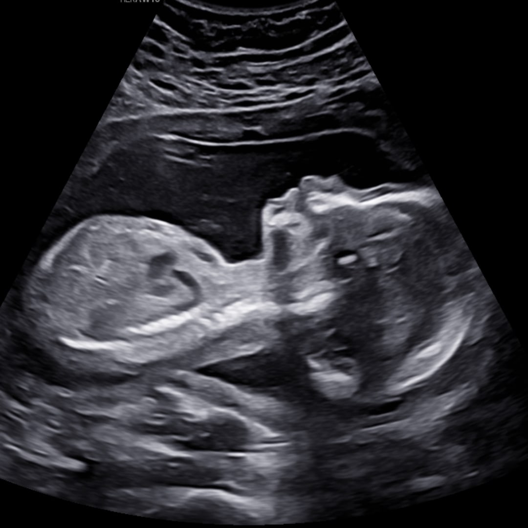 Photo shared by Emily for their Babylist baby registry.