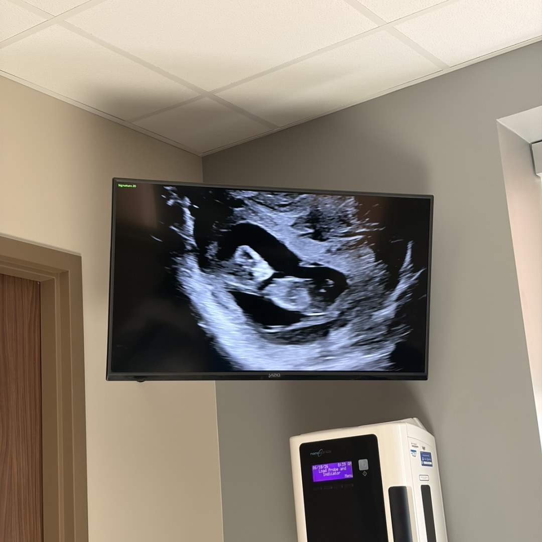 Photo shared by Chase for their Babylist baby registry.