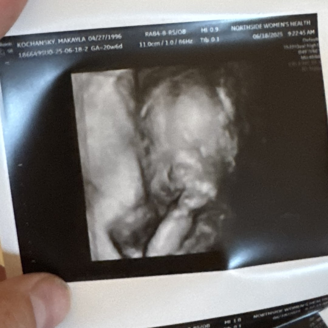 Photo shared by MaKayla for their Babylist baby registry.
