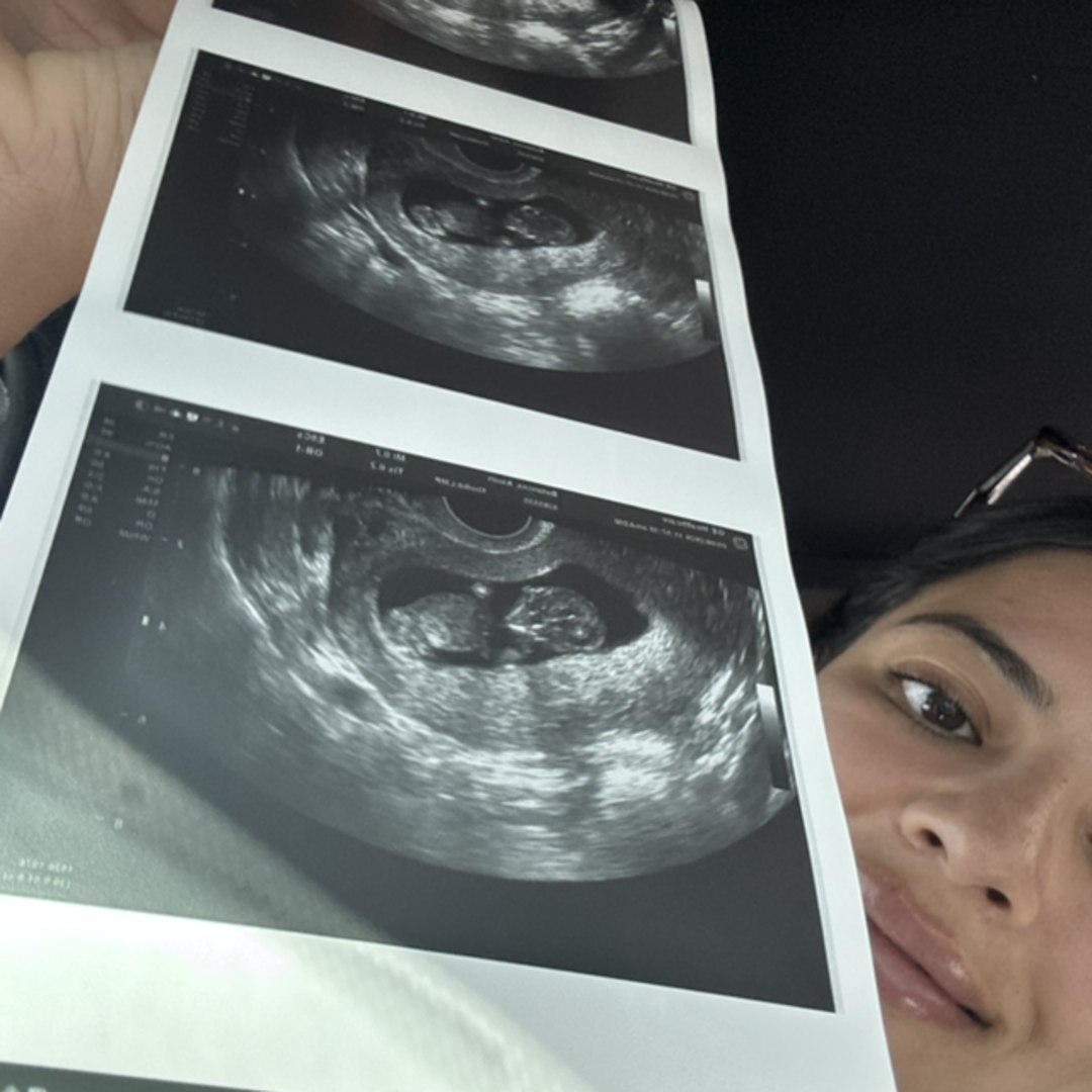 Photo shared by Aleah for their Babylist baby registry.