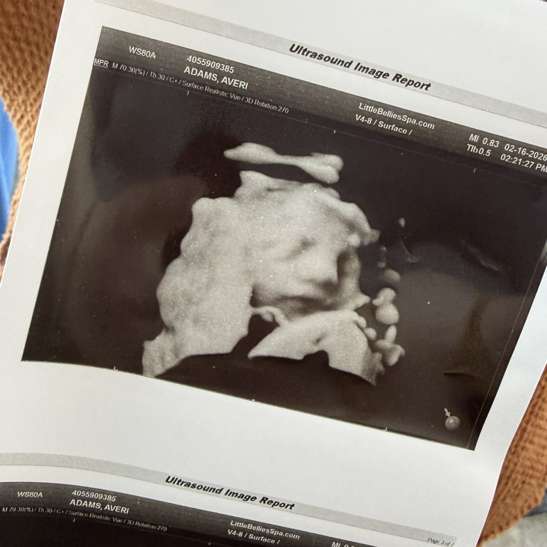 Photo shared by Averi for their Babylist baby registry.