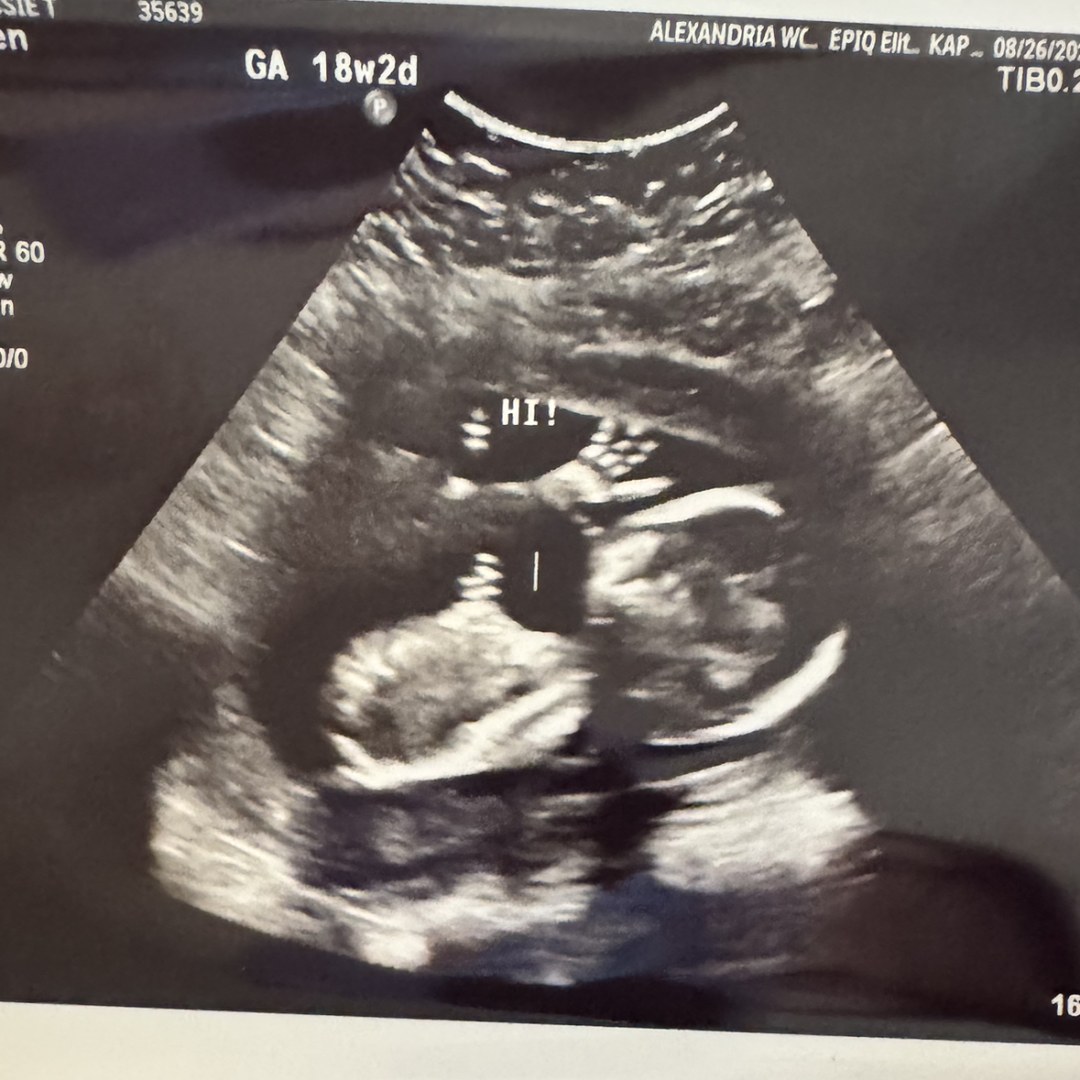 Photo shared by Jessie for their Babylist baby registry.